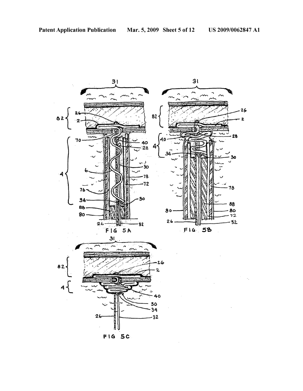 CLOSURE MEDICAL DEVICE - diagram, schematic, and image 06