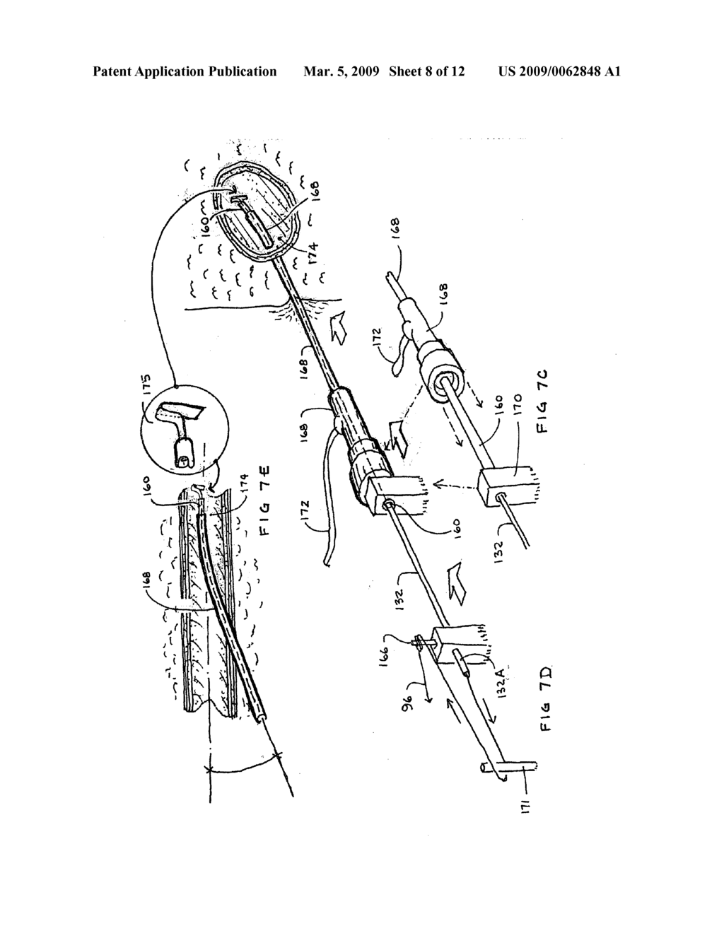 CLOSURE MEDICAL DEVICE - diagram, schematic, and image 09