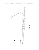 ANNULAR REPAIR DEVICE AND METHODS diagram and image