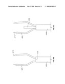 ANNULAR REPAIR DEVICE AND METHODS diagram and image