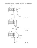 ANNULAR REPAIR DEVICE AND METHODS diagram and image