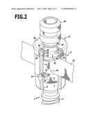 Orthopedic retaining system diagram and image