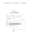 PEDICLE SCREW diagram and image