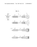 PEDICLE SCREW diagram and image