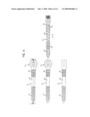 PEDICLE SCREW diagram and image