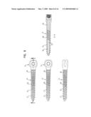 PEDICLE SCREW diagram and image