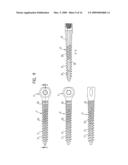 PEDICLE SCREW diagram and image