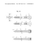 PEDICLE SCREW diagram and image