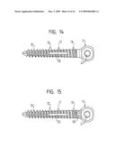 PEDICLE SCREW diagram and image