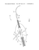 Pancreas lead diagram and image