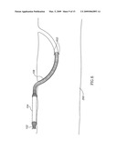 Pancreas lead diagram and image