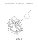 MEDICAL DEVICE ELECTRODES HAVING CELLS DISPOSED ON NANOSTRUCTURES diagram and image