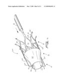 Vascular device with valve for approximating vessel wall diagram and image