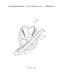 Hoof pick measure tool diagram and image