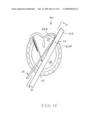 Hoof pick measure tool diagram and image