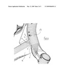 MOTOR VEHICLE FLEXIBLE AXLE, COMPRISING A CROSS BRACING WITH OPEN CROSS-SECTION WHEREOF THE FLANKS INCLUDE RECTILINEAR EDGES, CROSS BRACING AND CORRESPONDING MOTOR VEHICLE diagram and image