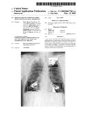 Presentation of computer-aided detection/diagnosis (CAD) results diagram and image