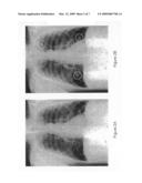 Presentation of computer-aided detection/diagnosis (CAD) results diagram and image