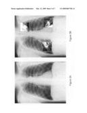 Presentation of computer-aided detection/diagnosis (CAD) results diagram and image