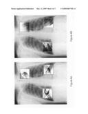 Presentation of computer-aided detection/diagnosis (CAD) results diagram and image