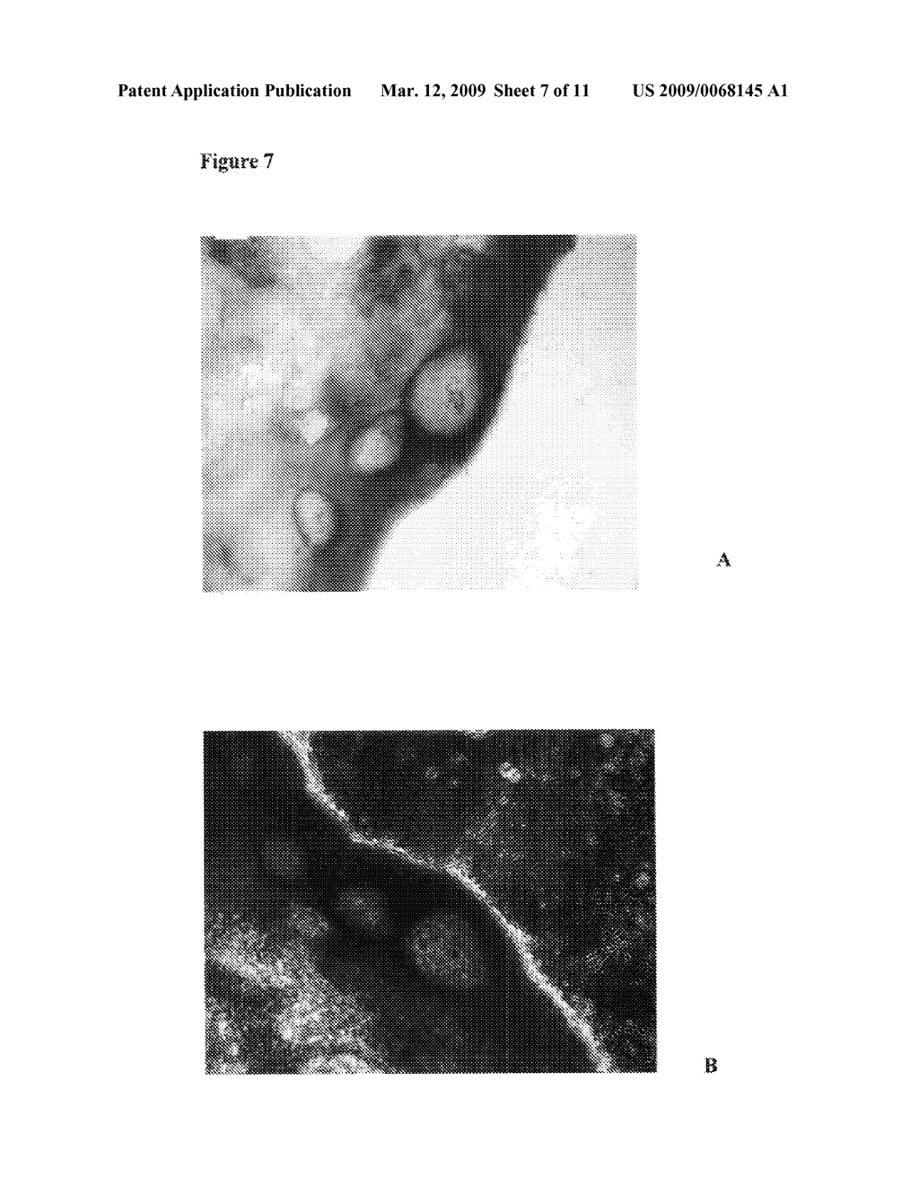 Methods and Compositions Relating to Islet Cell Neogenesis - diagram, schematic, and image 08