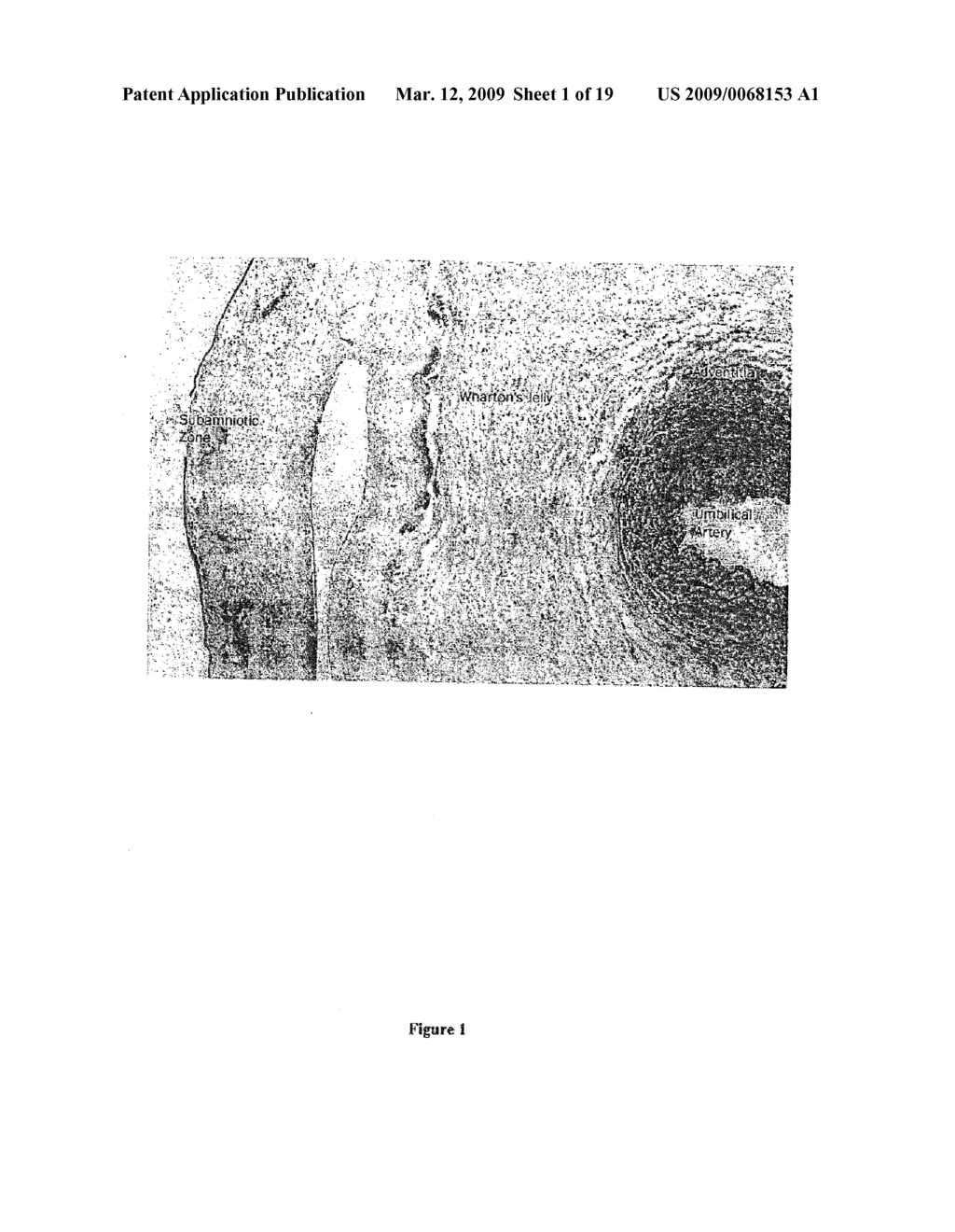 CELL COMPOSITION FOR TISSUE REGENERATION - diagram, schematic, and image 02