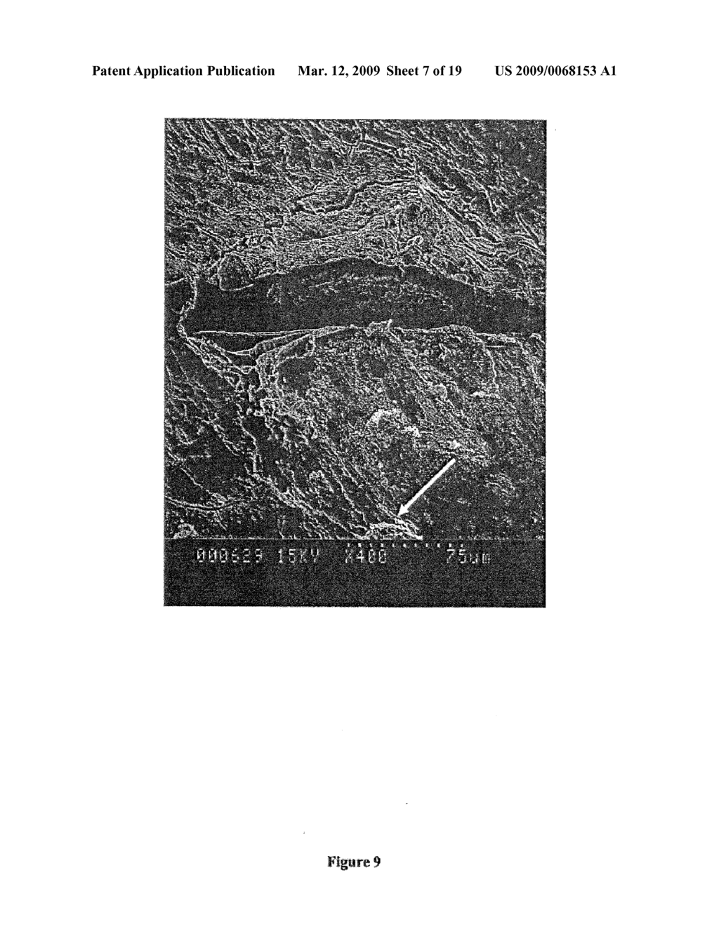 CELL COMPOSITION FOR TISSUE REGENERATION - diagram, schematic, and image 08