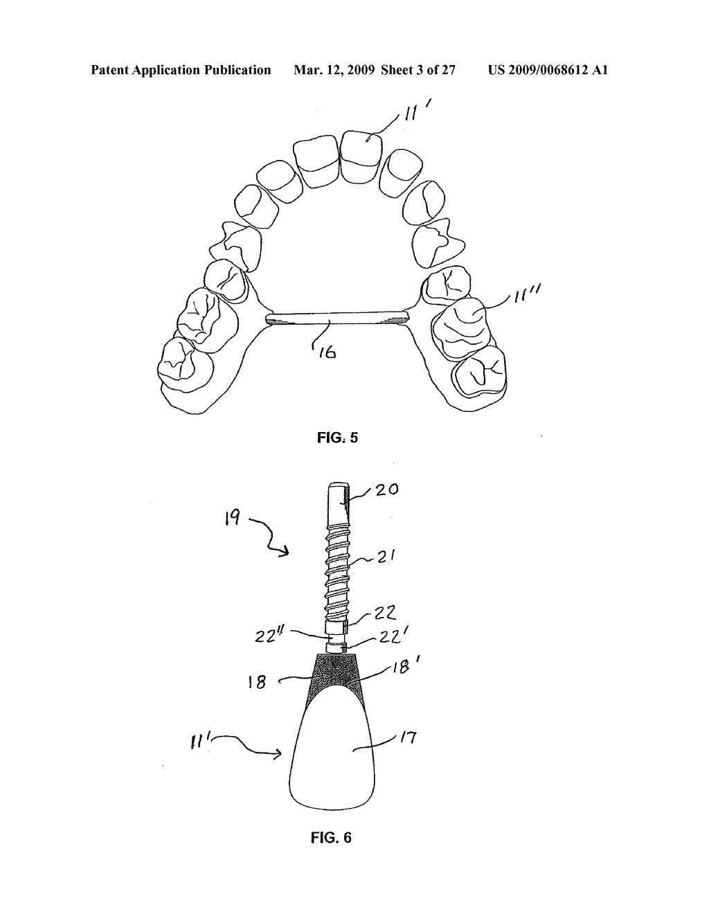 TOOTH POSITIONERS, METHOD OF MAKING THE SAME, AND METHOD OF POSITIONING TEETH USING THE SAME - diagram, schematic, and image 04