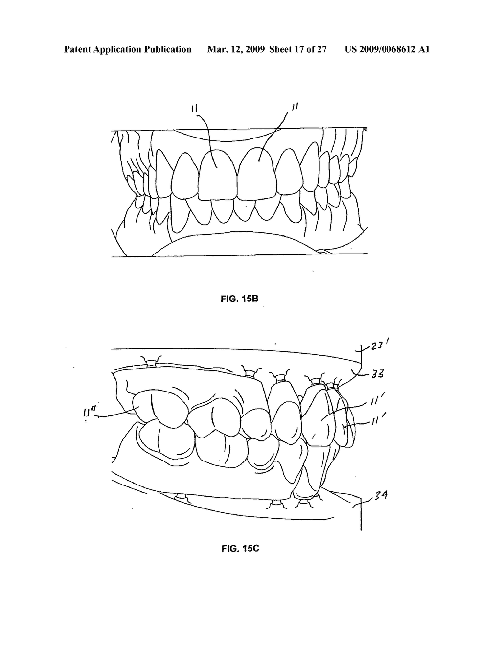 TOOTH POSITIONERS, METHOD OF MAKING THE SAME, AND METHOD OF POSITIONING TEETH USING THE SAME - diagram, schematic, and image 18