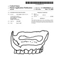 Method of denture fixation diagram and image