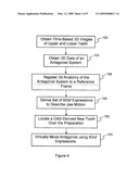 Method Of Designing Dental Devices Using Four-Dimensional Data diagram and image