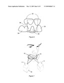 Method Of Designing Dental Devices Using Four-Dimensional Data diagram and image