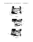 Method Of Designing Dental Devices Using Four-Dimensional Data diagram and image