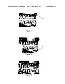 Method Of Designing Dental Devices Using Four-Dimensional Data diagram and image