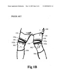 Leg straps with horizontal handles diagram and image