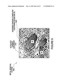 Removing metals from solution using metal binding compounds and sorbents therefor diagram and image