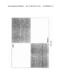 COMPOSITIONS AND METHODS FOR TREATING DIABETIC EYE DISEASE diagram and image