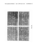 COMPOSITIONS AND METHODS FOR TREATING DIABETIC EYE DISEASE diagram and image