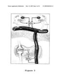 Compositions and Methods for the Treatment of Disorders Associated with Aberrant Vasodilation diagram and image