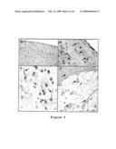 Compositions and Methods for the Treatment of Disorders Associated with Aberrant Vasodilation diagram and image