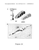 Compositions and Methods for the Treatment of Disorders Associated with Aberrant Vasodilation diagram and image