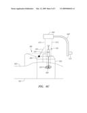 STABILIZER AND METHOD FOR IRRADIATING TUMORS diagram and image