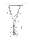 Retraction Apparatus And Method Of Use diagram and image