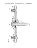 Retraction Apparatus And Method Of Use diagram and image