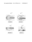 SIZING AND POSITIONING TECHNOLOGY FOR AN IN-THE-EAR MULTI-MEASUREMENT SENSOR TO ENABLE NIBP CALCULATION diagram and image