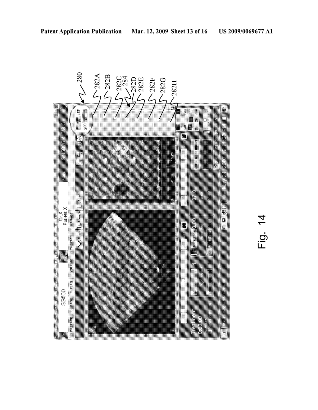 SYSTEM AND METHOD FOR TISSUE CHANGE MONITORING DURING HIFU TREATMENT - diagram, schematic, and image 14