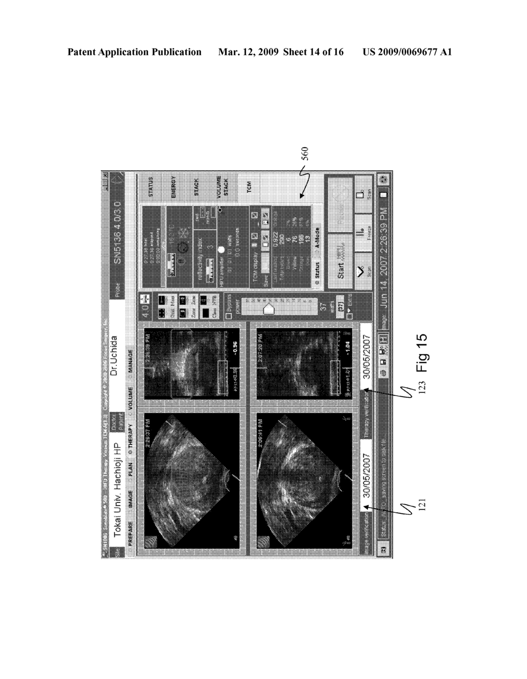 SYSTEM AND METHOD FOR TISSUE CHANGE MONITORING DURING HIFU TREATMENT - diagram, schematic, and image 15