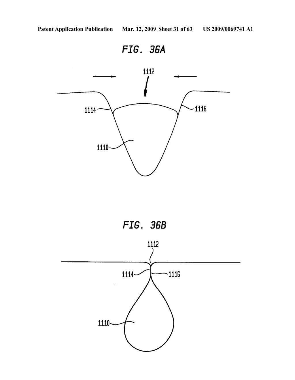 Methods And Devices For Fractional Ablation Of Tissue For Substance Delivery - diagram, schematic, and image 33