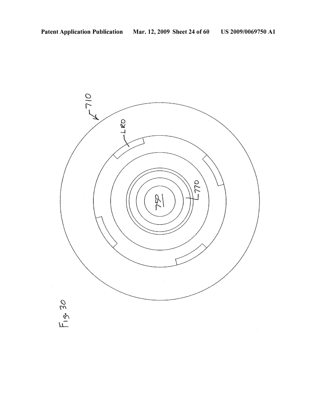 INFUSION DEVICE AND METHOD OF USING AND MAKING THE SAME - diagram, schematic, and image 25