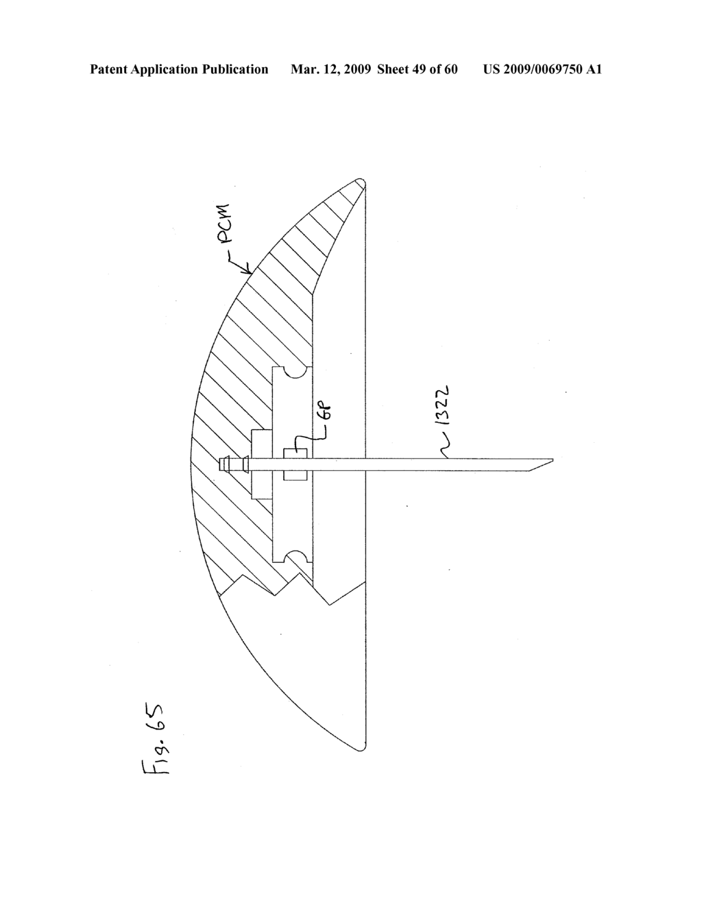 INFUSION DEVICE AND METHOD OF USING AND MAKING THE SAME - diagram, schematic, and image 50